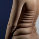 Illustration for article titled Photographer stretches skin to freaky limits without Photoshop